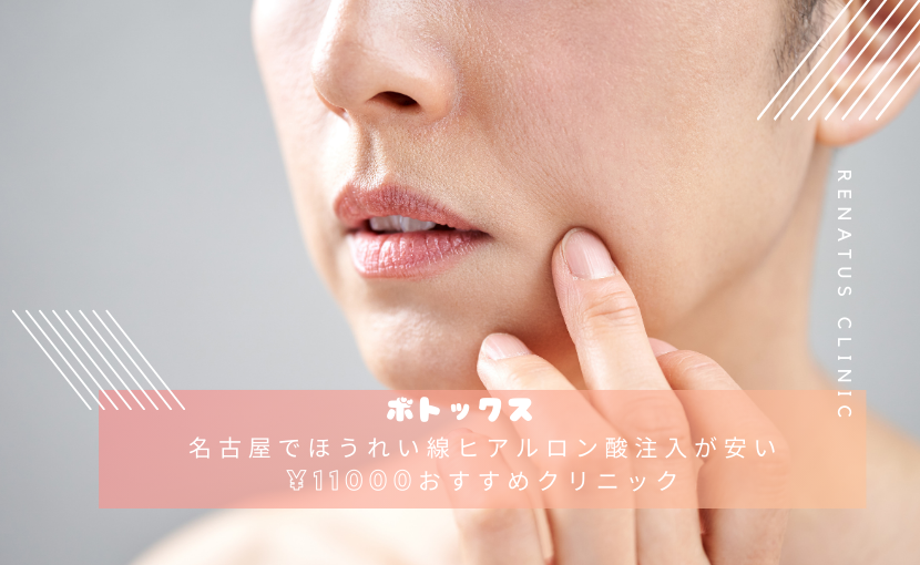 名古屋でほうれい線ヒアルロン酸注入が安い¥11000おすすめクリニック